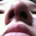 Nostrils are very uneven due to swelling but I don't really care