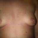 day before my surgery