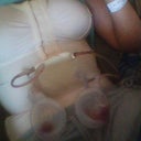 day after surgery