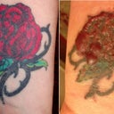 The original tattoo and the tattoo blistered after 2nd session