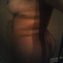 at 3 wk lower back still swollen