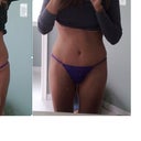 PO 21 - I hope this turns out, but this is me side by side with my pre-op undies.   I can't pinpoint exactly what the difference is in my silhouette.  It looks like my torso is shorter, I think maybe it's that my BB is lower somehow and also I'm still a little hunched.  He got pretty right on, although I do have to raise the sides a little to cover the scar.  My scar will still hide nicely under the lowest bikini I would probably ever wear!