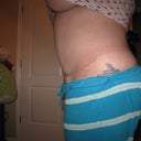 12 weeks / 3 months P/O