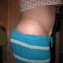 12 weeks / 3 months P/O