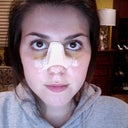 December 21 Day 6 after surgery. Stupid picture, but it really shows how yellow I am under the eyes.