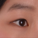 Double Eyelid Surgery Should Be Taken With Forehead & Eyebrow Lift
