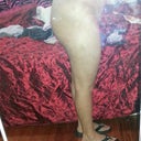 4 months post op