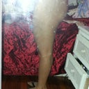 4 months post op