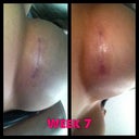 Scars week 7