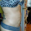 Side view before getting wrapped 4/15