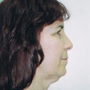 Before Profile