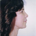 After profile