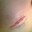 Incision, I think this one looks like a vagina lol