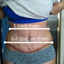 PO Day 9: swollen but shrunken from pre op measurements