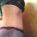 side view. hipsters cover the scar so that is good.
