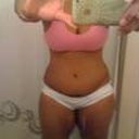 3 weeks post- op
yea!!! no more tape