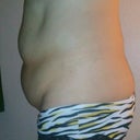 My front butts