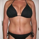 30 days PO:  Same bikini as in before pic