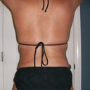 30 days PO:  Back view...no more back rolls...yeah!