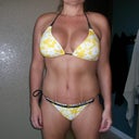 30 days PO:  Here's my new bikini!  Look how low it goes and still doesn't show my scar...Super happy about that!  :)