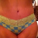 8 Weeks PO, front view