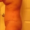 left side 7 wks