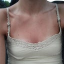 Photo #1: (Day 1) On my way to surgery