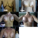 Progression from START TO FINISH!