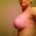 8 weeks. Left side