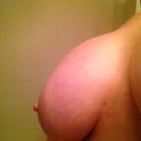 8 weeks. Right breast. Looks like a snoopy deformity to me.