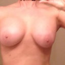 My left one is the bigger more round one. I'm thinking CC. Right one is smaller. I think snoopy deformity. 8 weeks.