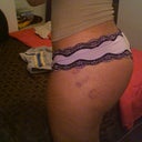 minimal bruising day 19