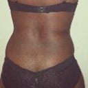 Back View before