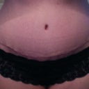 4 weeks - scar