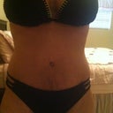 3 weeks post op - belly is bruised still :(