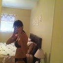 3 weeks post op - sideways shot (still hunched over slightly)