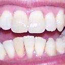 7-18-2012 Tray 10/24