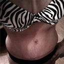 23 Days POST OP: Tape off the scar, massaging twice daily with pressure. Bio Oil. Still fresh but looking decent.
