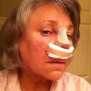 the day of surgery