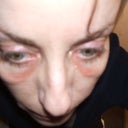 looking down on cheeks