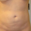 6 wks front view.