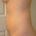 6 wks side view.