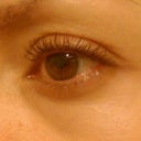 Left eye before