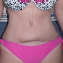 14 weeks 2 days PO
