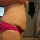 5 days after concerned obout the hang over.