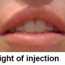 1 hour after injection