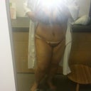 3 days post op