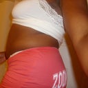 Pre-Op:  Side 6/25/12 (7 days before op)
