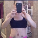 PO day 8 First thing in the morning right after the ol' binder came off. Its not super clear but you can see my bruising a little..its was pretty gnarly around my belly button and radiated out to right under my breasts.