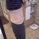 PO day 8 after shower and having binder off for about 30 minutes.